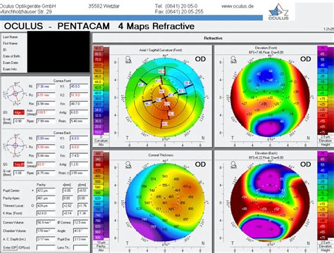 measure anterior posterior thickness|A Guide to Corneal Topography with Cheat Sheet.